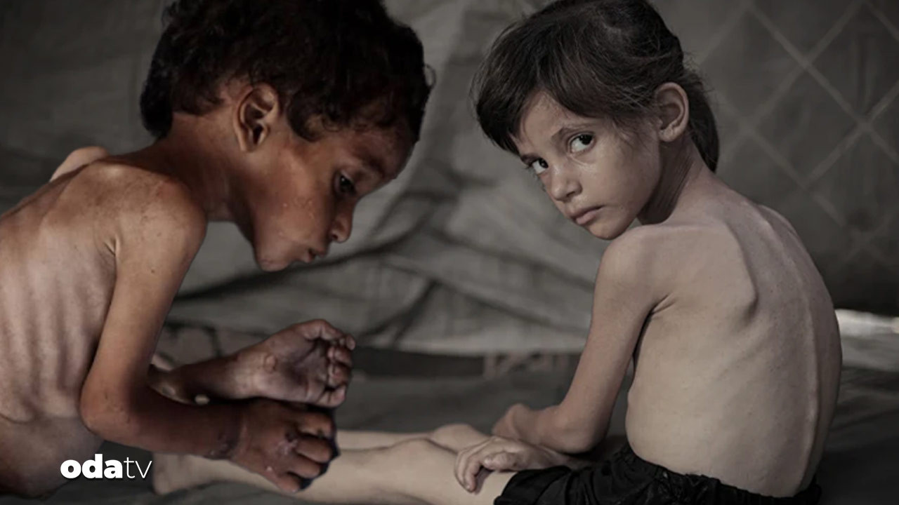 new york times daha fazla dayanamadi gazzede cocuklar acliktan eriyor hayatta kalanlarin gelecegi tehlikede ITEOIHUN