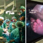 Ankarada anne karnindaki bebege dunyanin parmak isirdigi operasyon saatlerce suren ameliyatla gelen mucize 8AnyTtLX